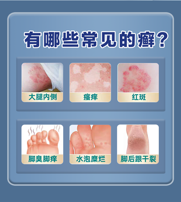 环吡酮胺_02.png